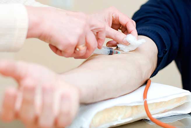 کبودی دست پس از خونگیری – آزمایشگاه تشخیص طبی سروش